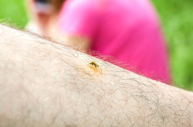 Mosquito sitting on the leg. insects bite in the summer.\
dangerous nature. itchy body.