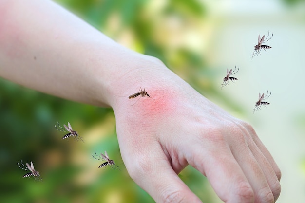 Photo mosquitoes bite on adult hand made skin rash and allergy with red spot