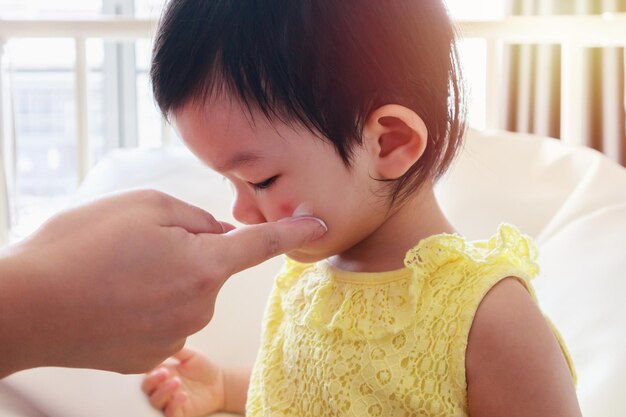 Photo mother applying antiallergic medicine cream at cute asian girl face with skin rash and allergy with red spot cause by mosquito bite