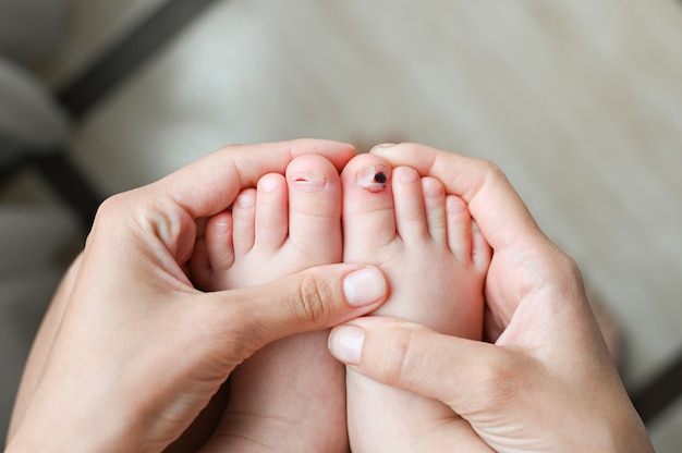 Mother holds her foot with a wounded toe