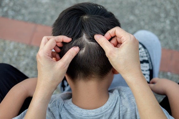 Mother is catching hair to find lice