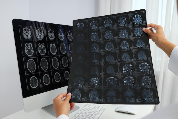 MRI-afbeeldingen van een menselijk hoofd in de handen van een arts