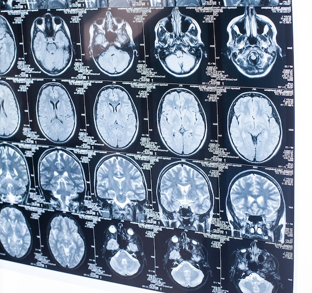 Photo mri of a human brain computed tomography, mri diagnostics