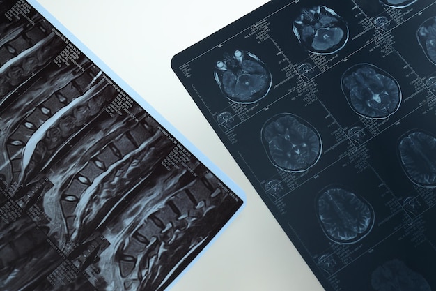 Photo mri or magnetic resonance imaging of the head and brain