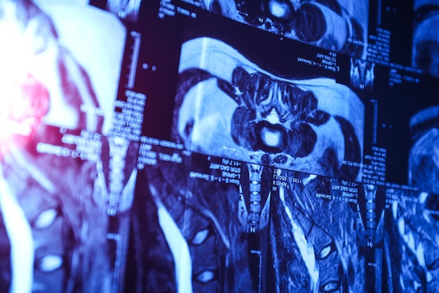 MRI of magnetische resonantie beeldvorming van het menselijk bekken Close Up