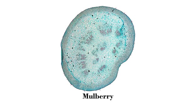 Foto mulberry cellen opname