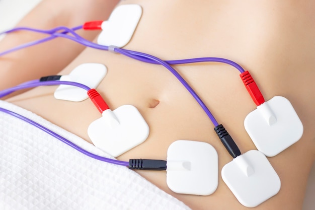 Photo myostimulation electrodes are placed on the abdomen