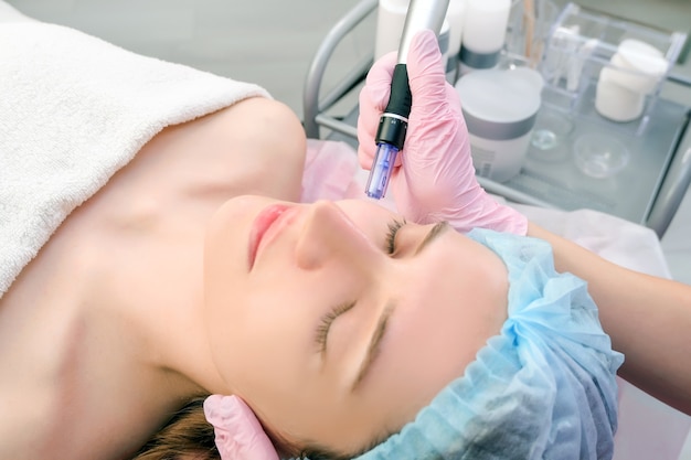 Naald mesotherapie. Cosmetologist voert mesotherapie met naalden uit op het gezicht van een vrouw. Mooie vrouw die microneedling verjongingsbehandeling krijgt. Naald tillen