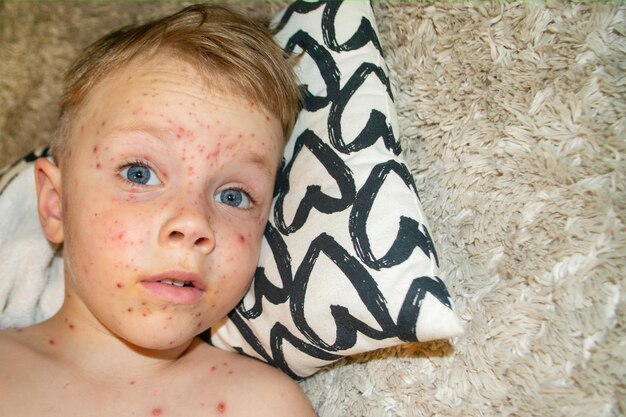 Foto vaccinazione naturale malattie contagiose