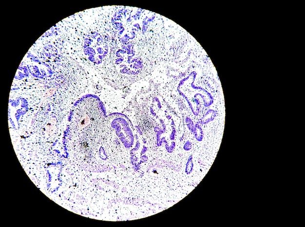 Nauwe microscopische weergave van histopathologisch gekleurd objectglaasje