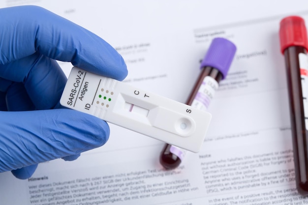 Negative test result by using rapid test device for COVID19