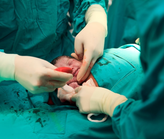 Newborn baby in labor room