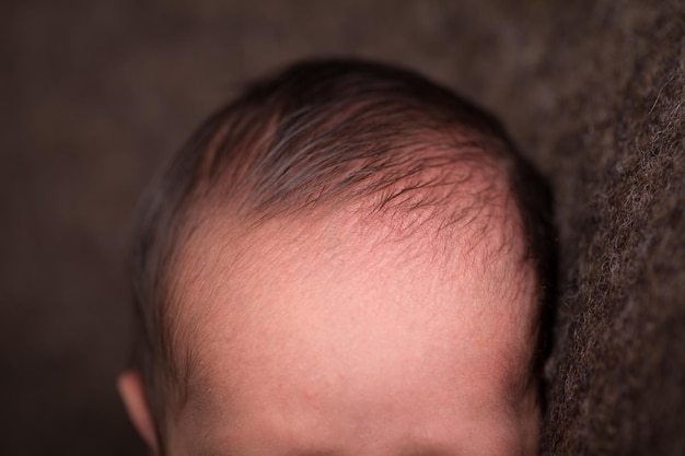 Newborn forehead head body part brain top of