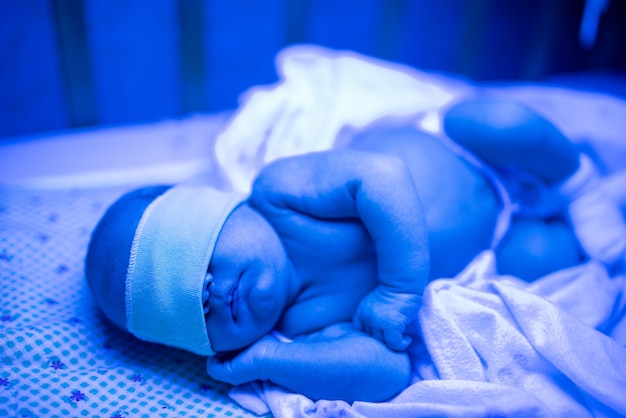 Newborn having a treatment for jaundice under ultraviolet lamp in home bed