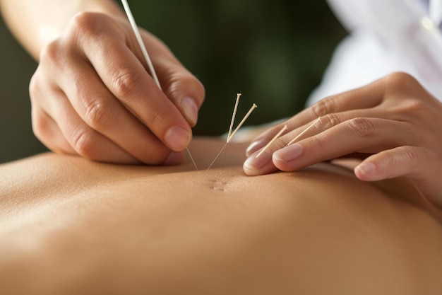 Photo noninvasive acupuncture treatment generate ai