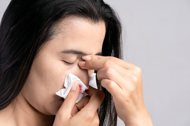 Nosebleed ,woman suffering from nose bleeding and using tissue paper