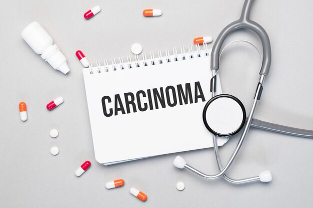 ノートブックには、聴診器、ピル、メガネの横に「CARCINOMA」というテキストがあります。