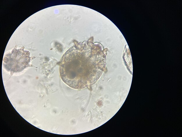 Photo notoedres cati under the microscope notoedric mange also referred to as feline scabies