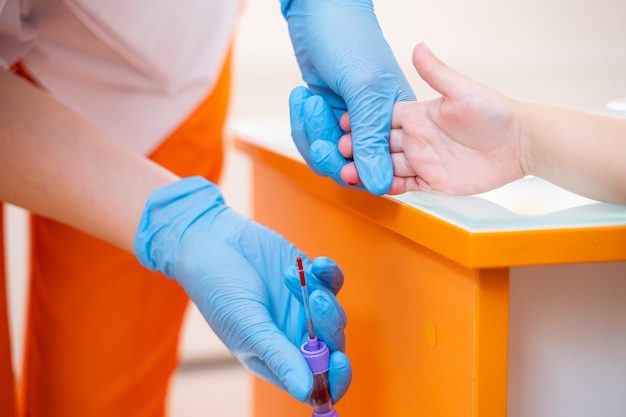 Nurse collects blood specimen from a finger