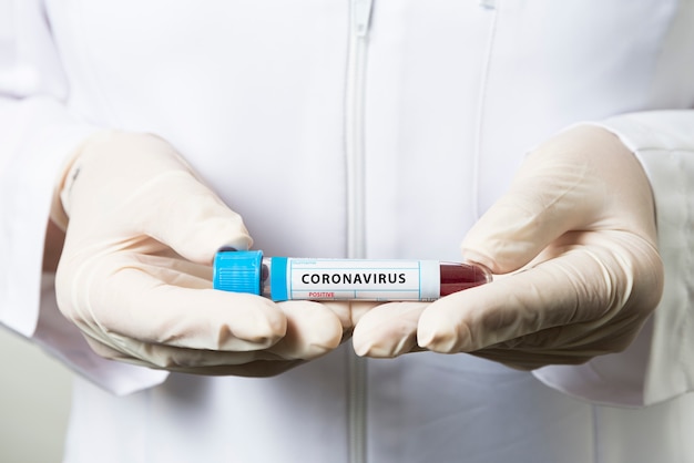 Nurse holding a positive result in the examination of a new fast-spreading coronavirus.