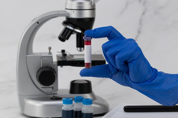 Nurse holding test tube with blood, close-up. Blood test concept.