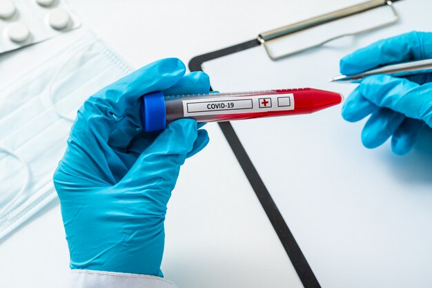 Nurse holding test tube with blood