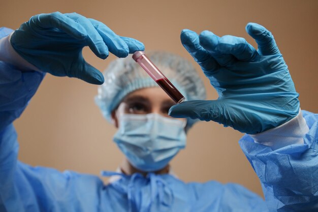 A nurse holds a test tube with a coronavirus positive blood sample 2019 nCoV pandemic MERS