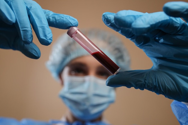 간호사가 코로나바이러스 양성 혈액 샘플 2019 nCoV 전염병 MERS가 있는 시험관을 들고 있습니다