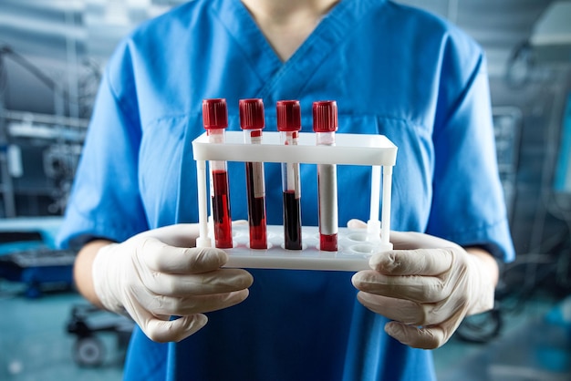 Nurse in hospital holding blood in test tubes for analysis