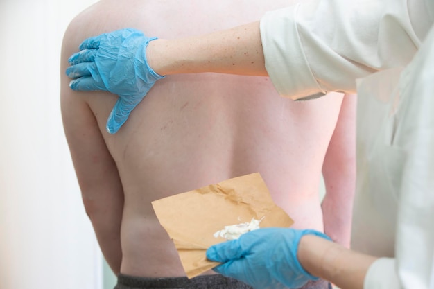 A nurse smears a body covered with an allergic rash to a patient