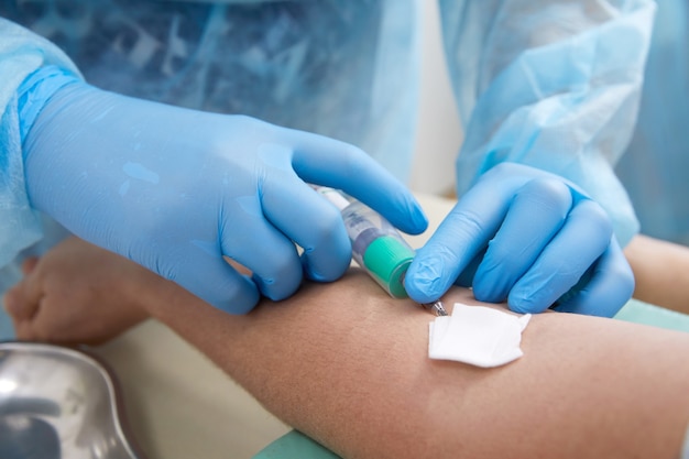 Nurse taking blood sample to make a test in laboratory