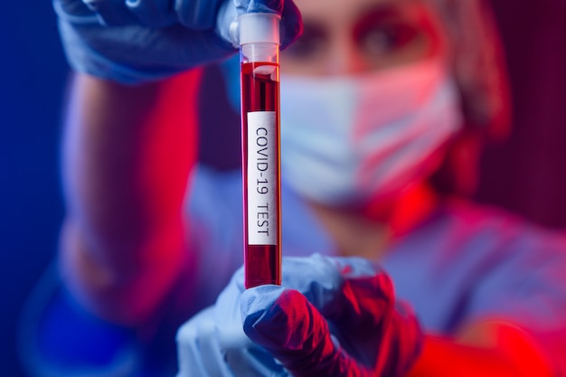 Nurse wearing respirator mask holding a blood test  for the new Coronavirus, covid-19. Coronavirus Pandemic Concept.