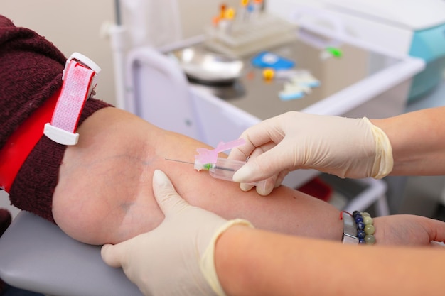 Photo nurse in white gloves is going to draw blood from vein woman for analysis