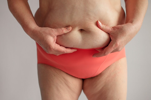 Obese woman with thick buttocks, obese female body