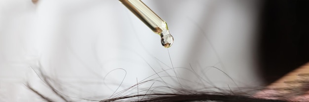 Oil from a pipette drips onto the hair on the head