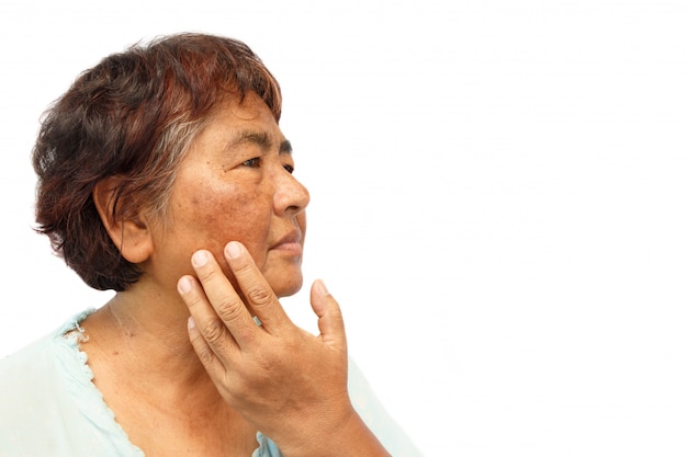 old rural woman with blemish 