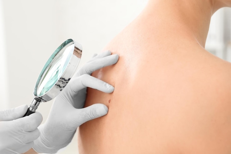 Photo oncologist examining patient with magnifier in clinic cancer awareness