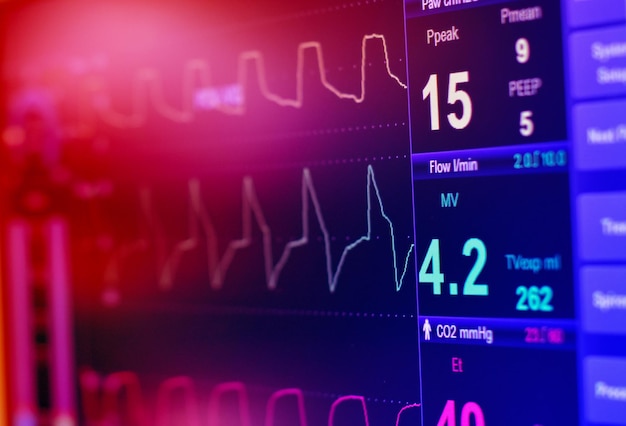 Onderzoek het ECG in een intraveneuze ballonpomp op de IC op een onscherpe achtergrond hersengolven in de hersengolven hartslaggolf