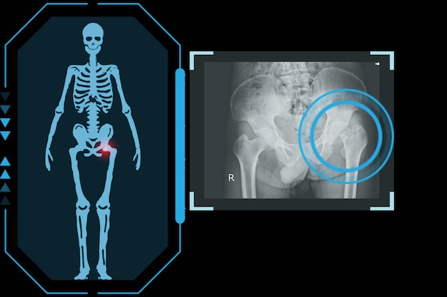 Foto onderzoekt een technologische digitale holografische plaat die het lichaam van de patiënt vertegenwoordigt osteoartritis