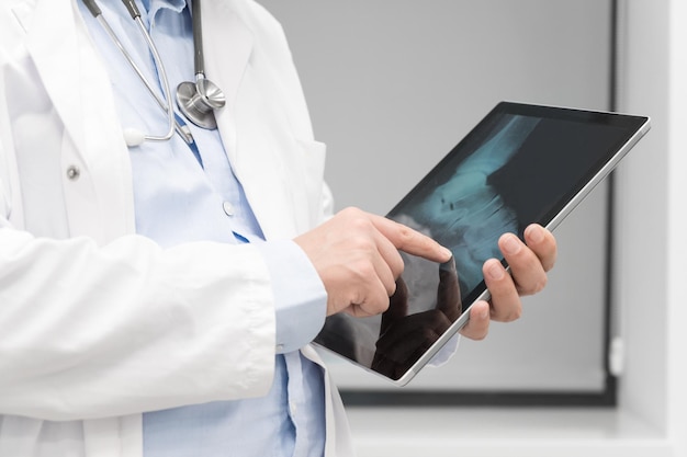 Onherkenbaar arts controleert röntgenfoto's op computertablet close-up Arts aan het werk in een ziekenhuis Geneeskunde en gezondheidszorgconcept