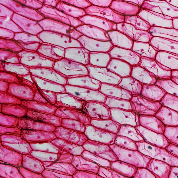 Photo onion epidermus micrograph