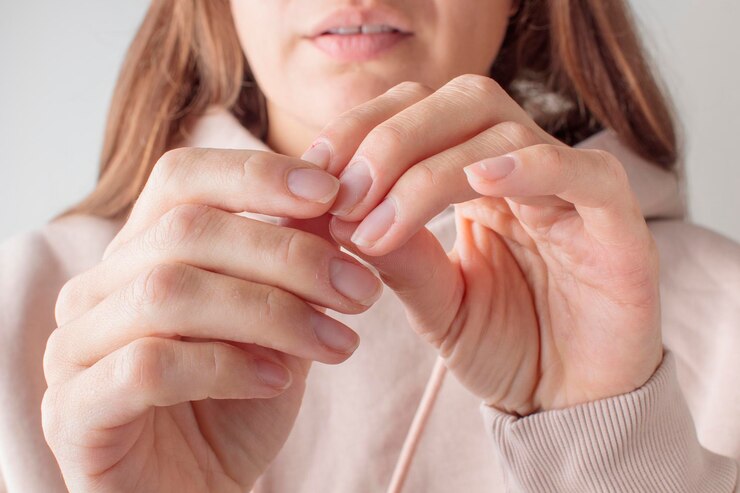 Onychophagy Een nerveuze jonge vrouw bijt haar nagel door stress en angst Concept van angst