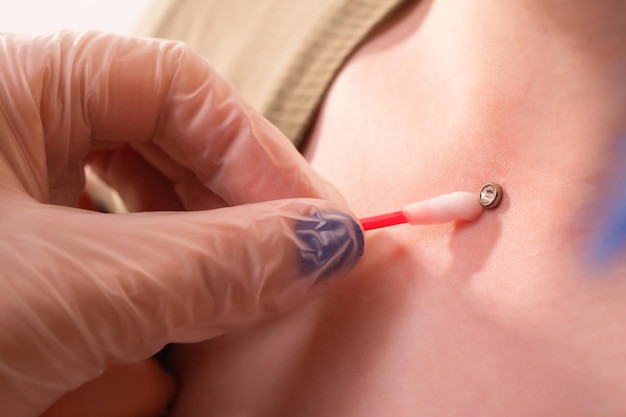 Operatie om microdermal piercing professionele plaatsing te installeren