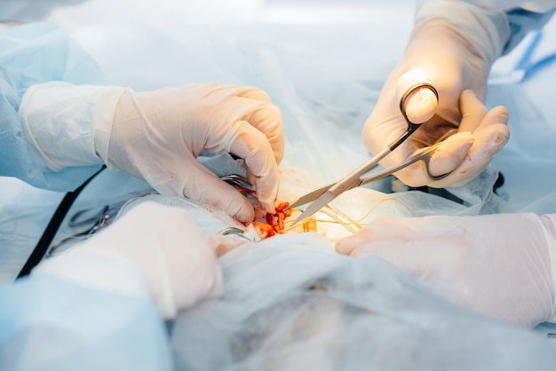 Operation in a modern operating room close-up, emergency rescue and resuscitation of the patient. Medicine and surgery