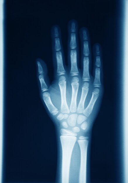 Original Radiography Of Human Hand