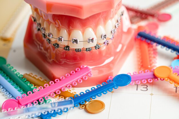 Photo orthodontic ligatures rings and ties elastic rubber bands on orthodontic braces model for dentist studying about dentistry