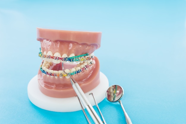 Orthodontic model and dentist tool on the blue background