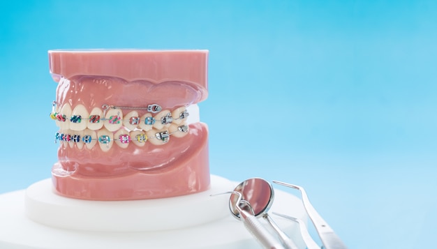 Photo orthodontic model and dentist tool demonstration teeth model of varities of orthodontic bracket or brace