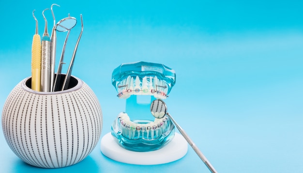 orthodontic model and dentist tool - demonstration teeth model of varities of orthodontic bracket or brace