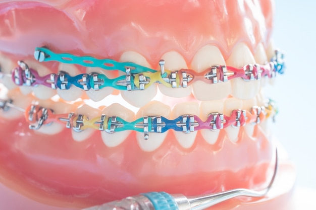 Ортодонтическая модель и инструмент стоматолога